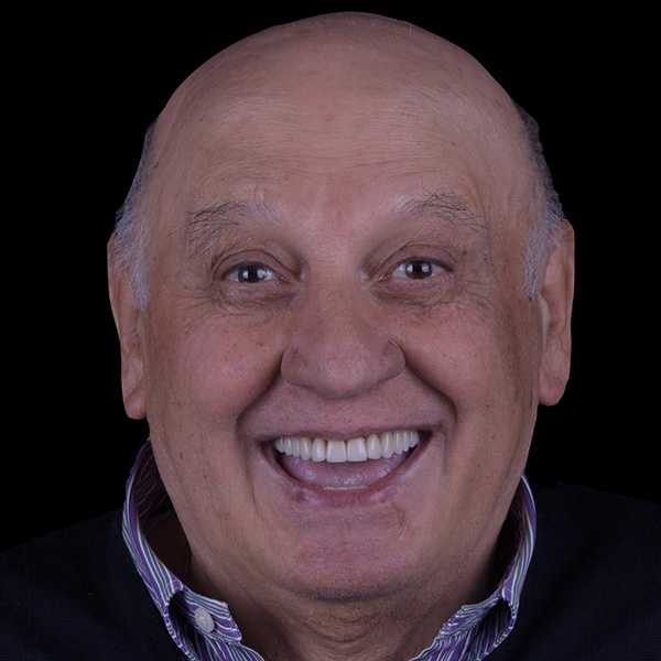 Faccette dentali Faccette Dentali Risultato 1 Pieroni