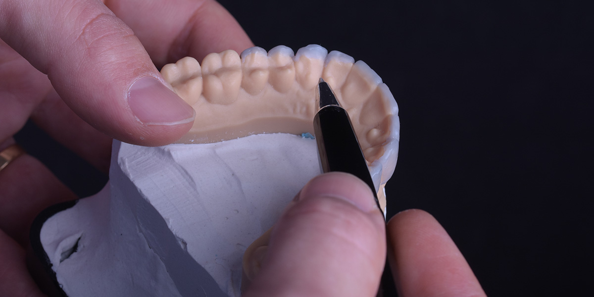 Faccette dentali Faccette Dentali Studio Caso Mockup Pieroni 1