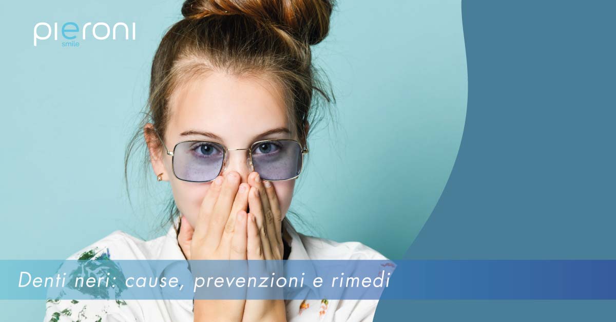 denti-neri-news||