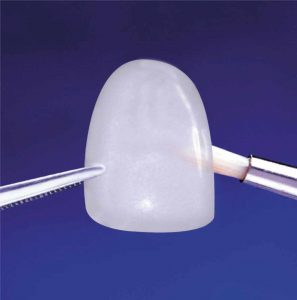Le faccette dentali si staccano? faccette-dentali-si-staccano-