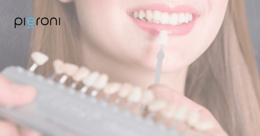 Faccette dentali: cinque cose che devi sapere prima del trattamento News 1 1 1024x536