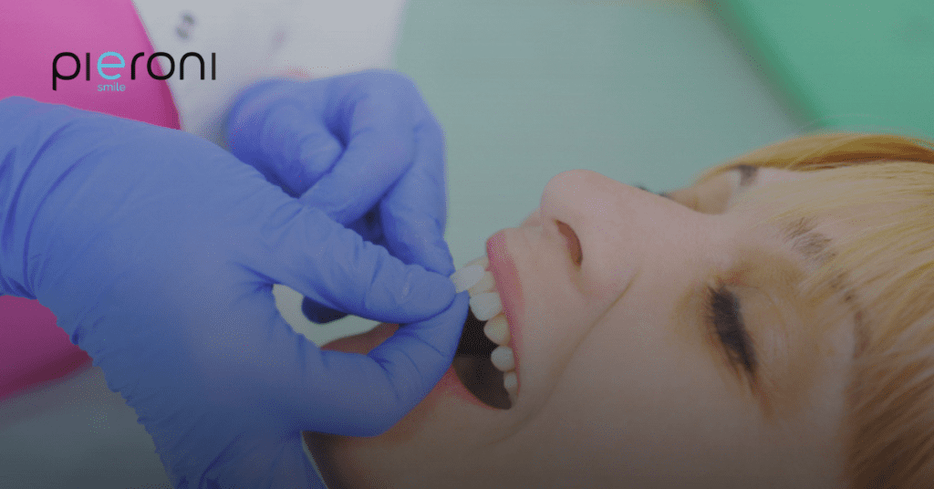 Faccette estetiche: due sedute per cambiare il tuo sorriso News Faccette 1024x536