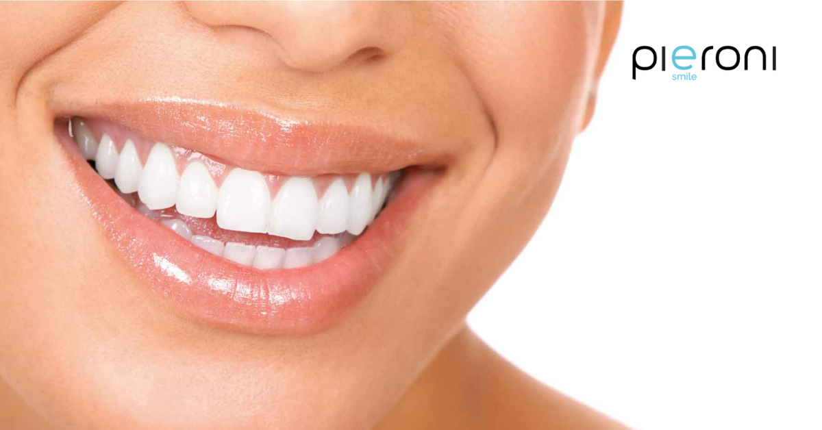 implantologia dentale estetica